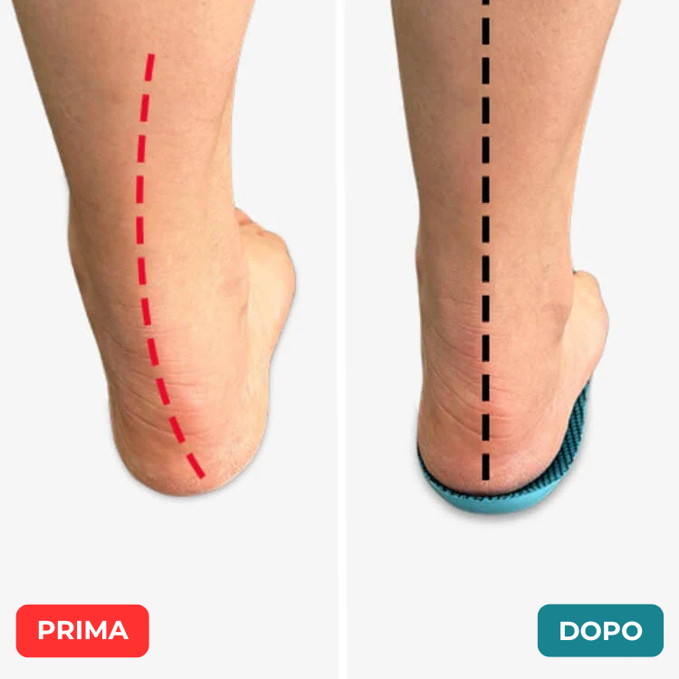 Enzica™ - Vivi senza dolore, senza cure costose o visite mediche...