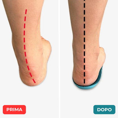 Enzica™ - Vivi senza dolore, senza cure costose o visite mediche...